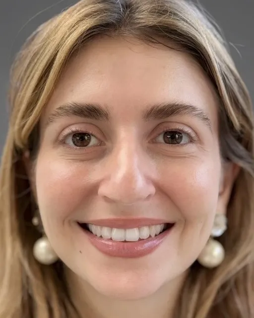 Simulation : le même sourire, avec des facettes dessinées sur mesure